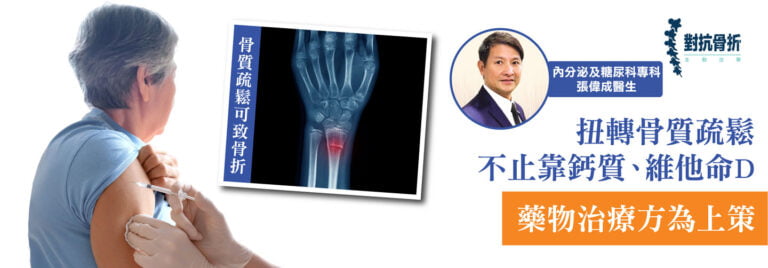 張偉成醫生骨質疏鬆的見解